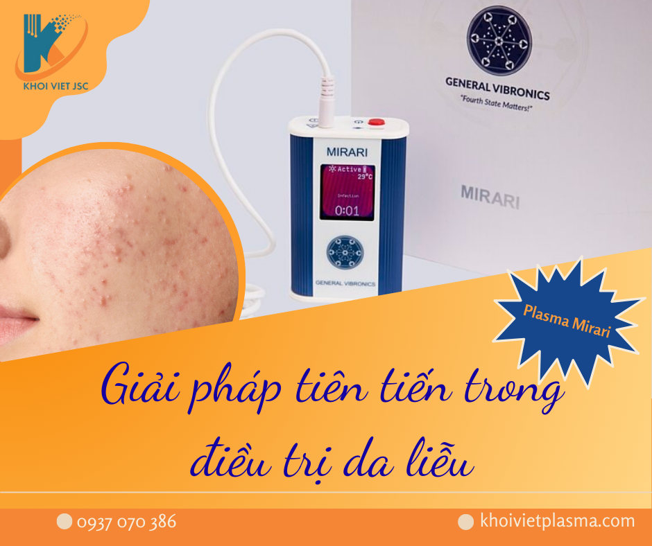Plasma Lạnh Mirari – Giải pháp tiên tiến cho bệnh da liễu