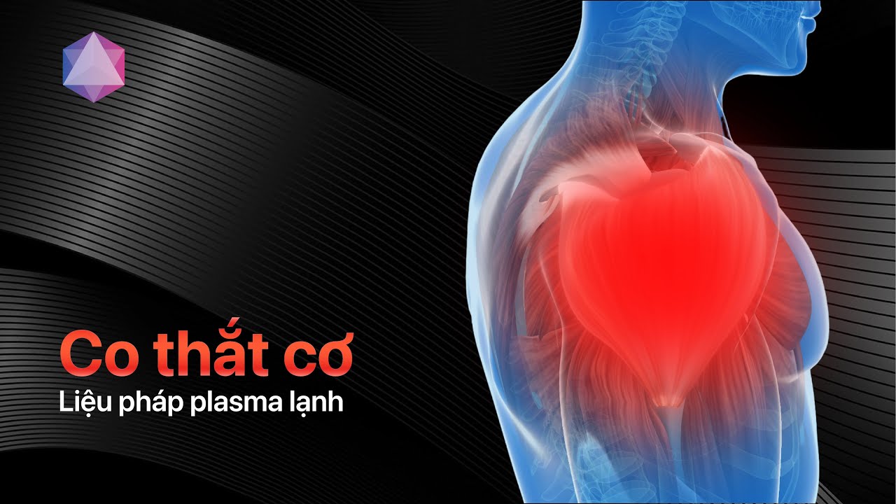 Hỗ trợ điều trị Co Thắt Cơ bằng liệu pháp Plasma Lạnh